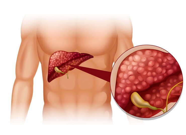 Advanced Liver Treatments & Diagnostics Offered in Mumbai