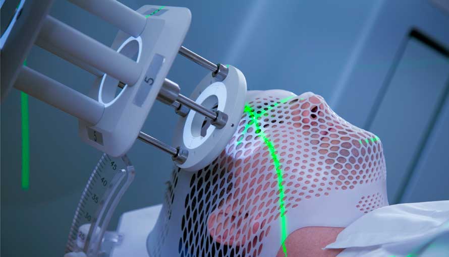 radiation-therapy